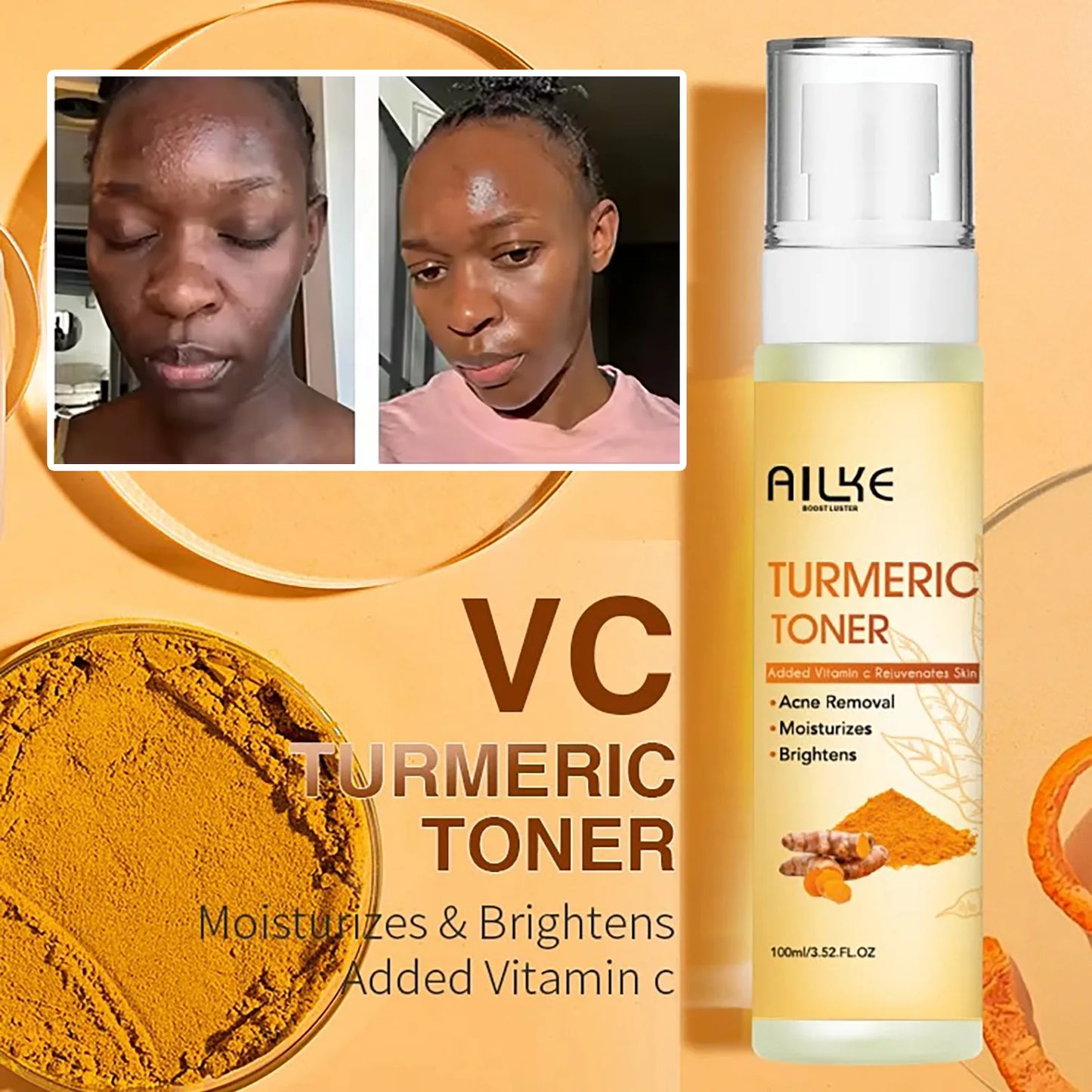 AILKE Organic Turmeric Skin Care Set, Brighten, Cleaning Skin, Reduce Acne, Whiten, Even Skin Tone, Improve Dry Skin