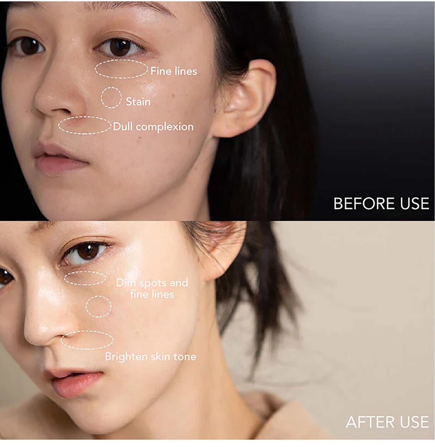 AILKE Whitening Dark Spot Remove Facial Skin Care Cream With Collagen Anti- Freckles Wrinkle Repair Women Premium Face Product