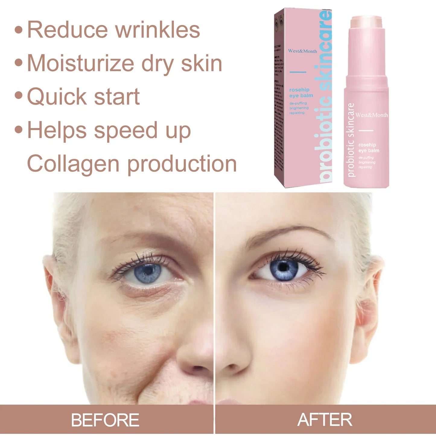 Wrinkle Reducing Cream Remove Dark Circle Firming Anti-ageing Fine Lines Moisturising Tighten Face Probiotic Skincare Cosmetics