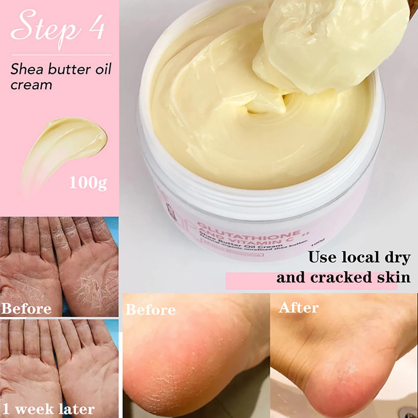 AILKE Skin Lightening Cream, Smooth Skin Glowing Lotion, With Glutathion, Shea Butter, Vitamin C, Moisturizing Body Cream